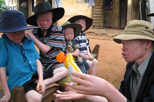SNUPA's leader Peter equipping young brothers with albinism with hats, sunscreen and knowledge to stay safe from skin cancer