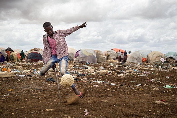 Mohammed, 13, lost his right leg in a bomb blast when he was shining shoes